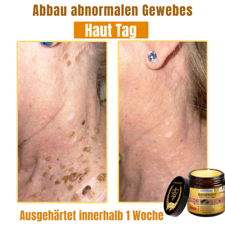 Fivfivgo® Profi Bienengift Alles-in-Einem Creme