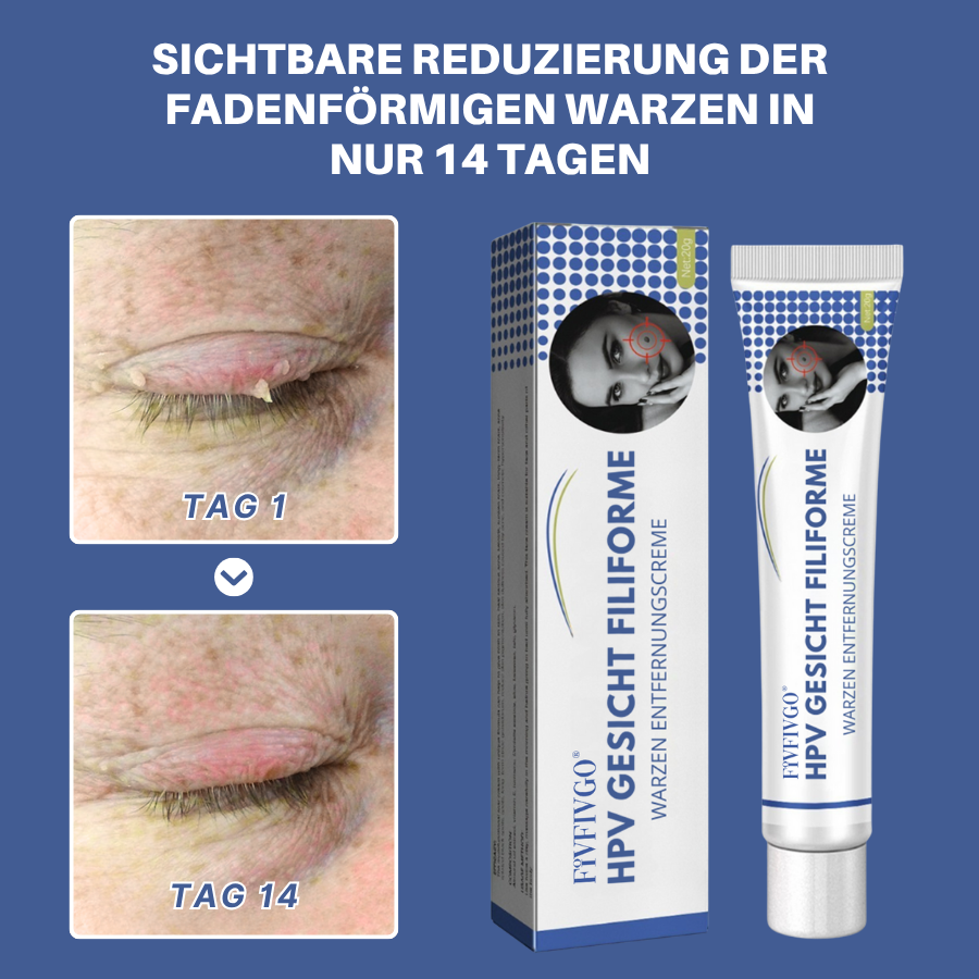 Fivfivgo® Profi HPV Gesicht Filiforme Warzen Entfernungscreme