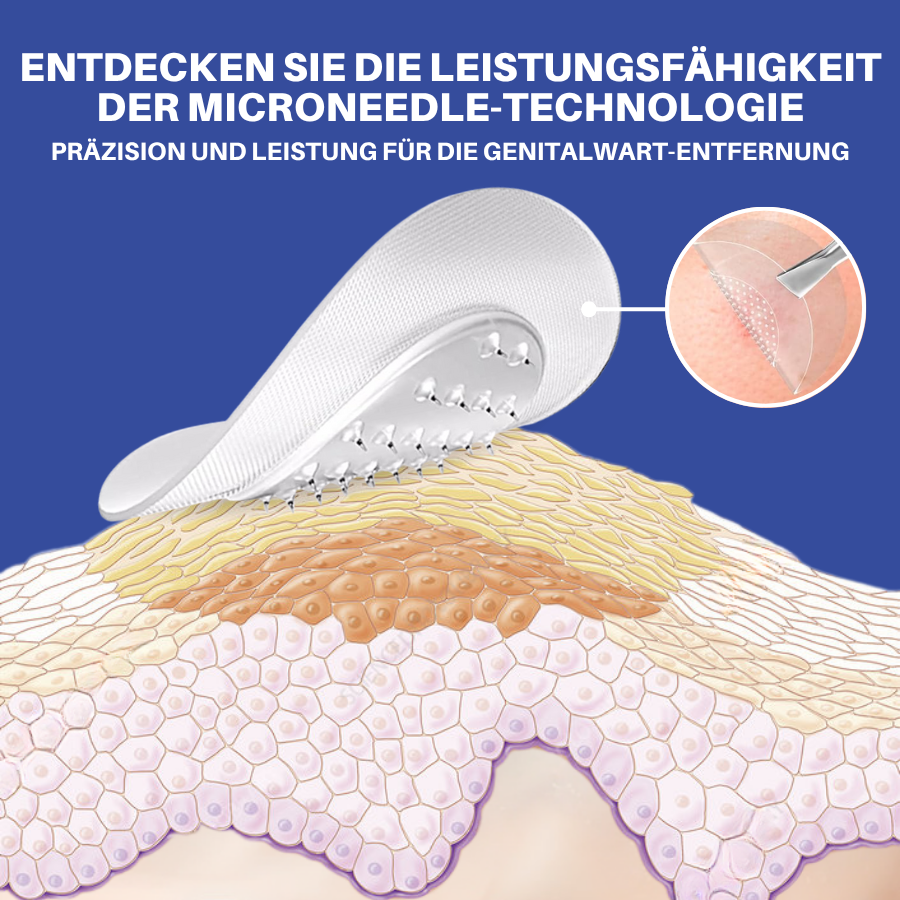 Fivfivgo® Profi Mikronadel HPV Genitalien Warzen Entfernung Patch