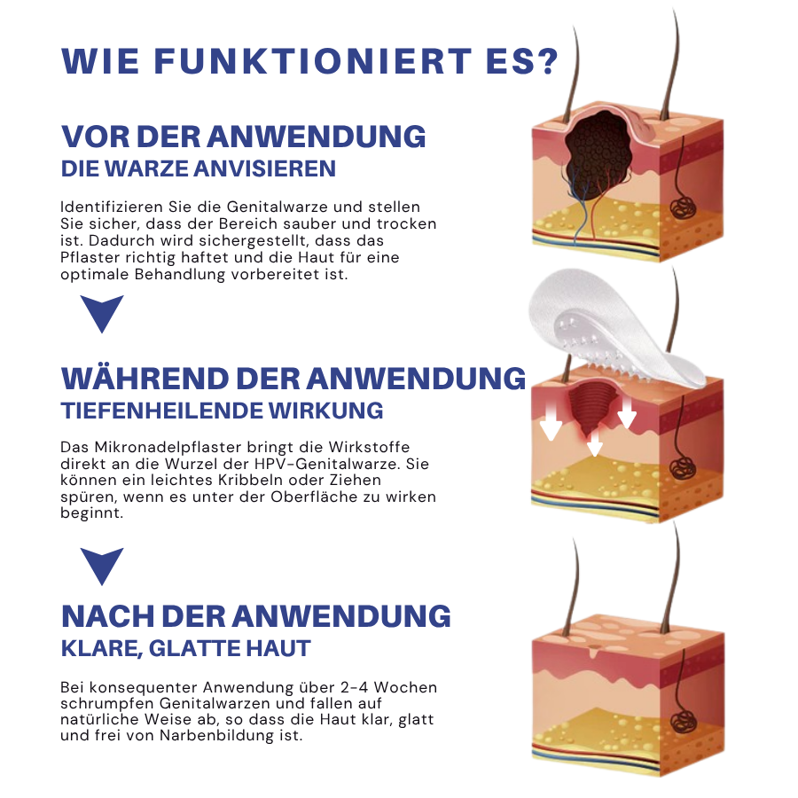 Fivfivgo® Profi Mikronadel HPV Genitalien Warzen Entfernung Patch