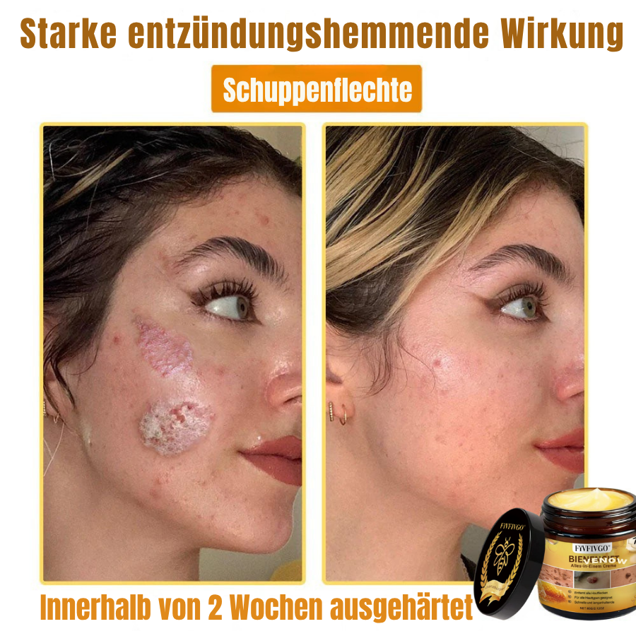 Fivfivgo® Profi Bienengift Alles-in-Einem Creme