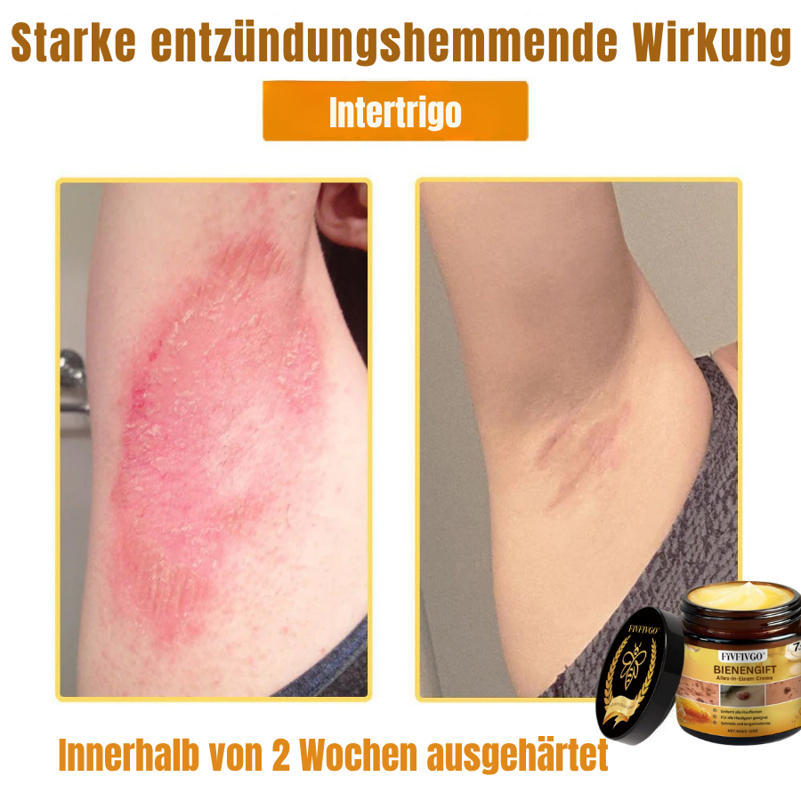 Fivfivgo® Profi Bienengift Alles-in-Einem Creme