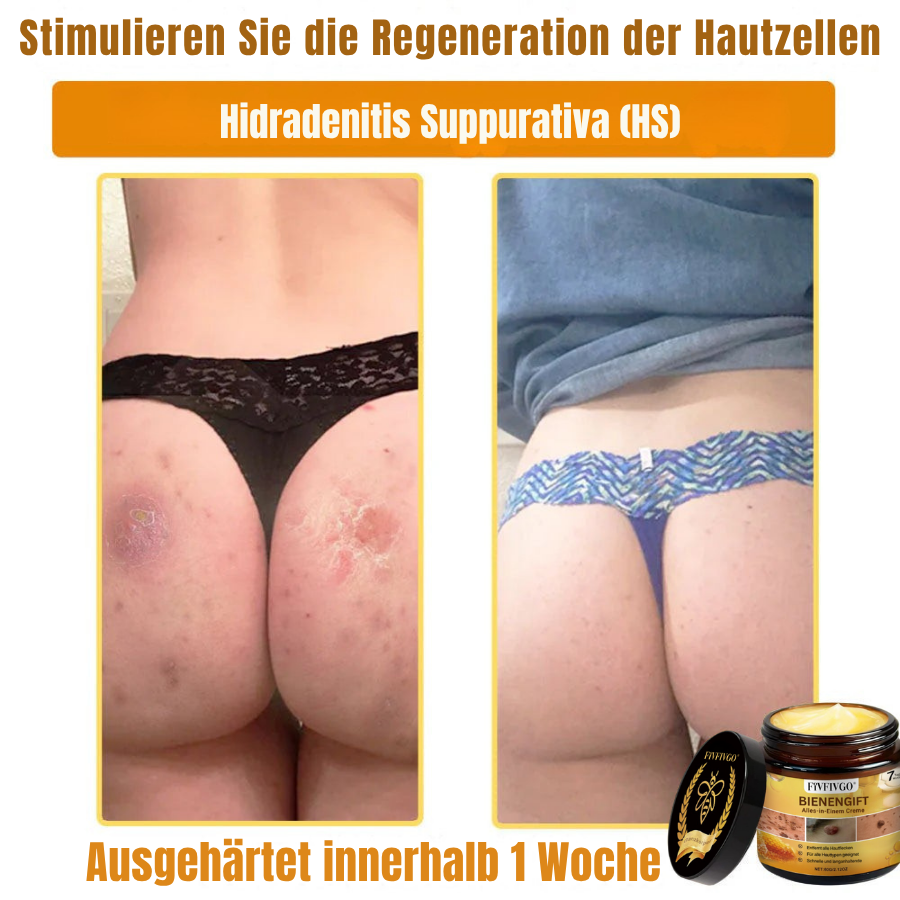 Fivfivgo® Profi Bienengift Alles-in-Einem Creme