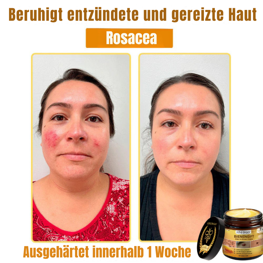 Fivfivgo® Profi Bienengift Alles-in-Einem Creme