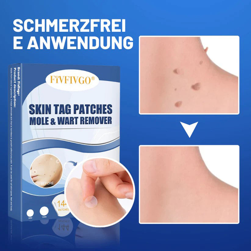 Fivfivgo® Profi Muttermale & Warzen entfernen Haut Tag Patch