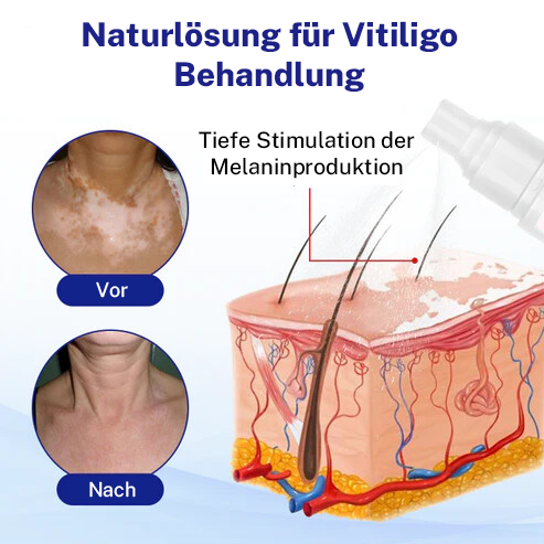 Oveallgo® Evenora Profi Kräuterspray