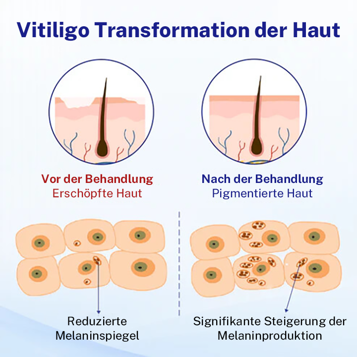 Oveallgo® Evenora Profi Kräuterspray