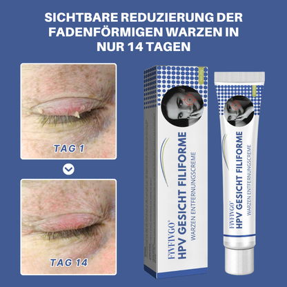 Fivfivgo® Profi HPV Gesicht Filiforme Warzen Entfernungscreme