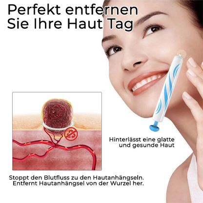 Bikenda® Stift zur Entfernung von Hautmarkierungen zu Hause
